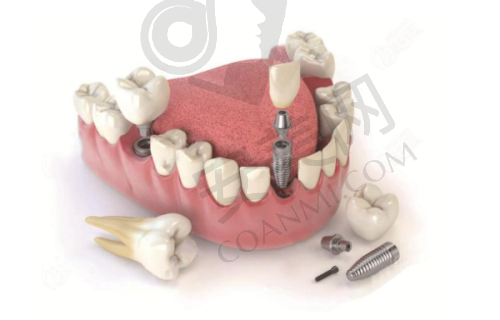3、重庆名博士口腔门诊部叶金平医生诊疗项目收费价格: