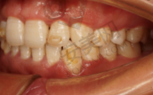 六、乌鲁木齐天使口腔-友好路院区预约挂号流程：