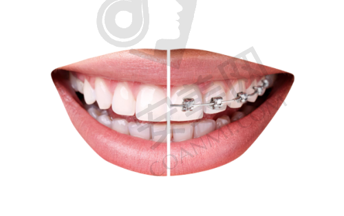 种植牙手术:紧张又期待