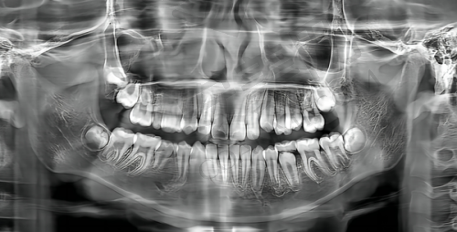 诊疗成效与感受总结