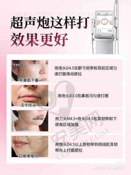 在宝鸡晶肤就诊的服务感受如何?