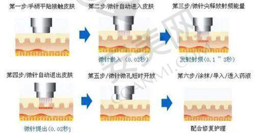 结论:选择适合自己的美丽之旅
