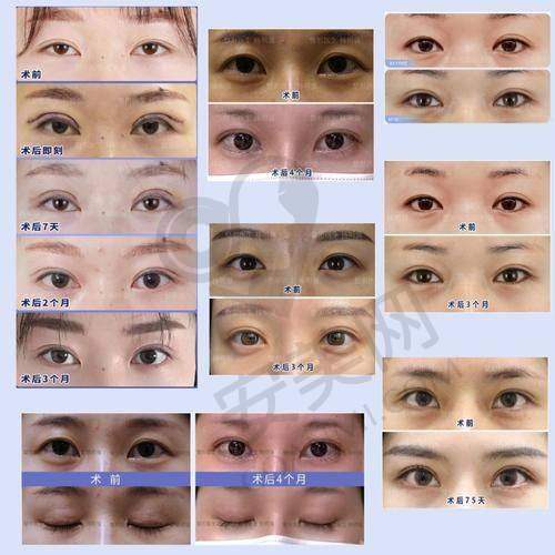 6、青岛博士王建宇医生预约挂号指南