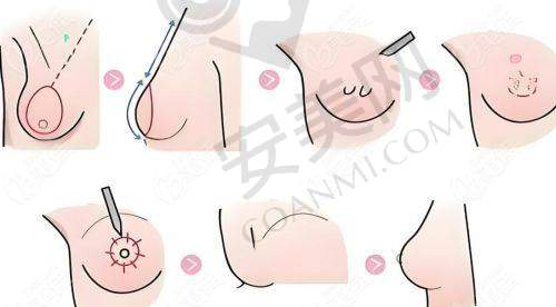 3、青岛博士杨永胜医生鼻整形技术怎么样?