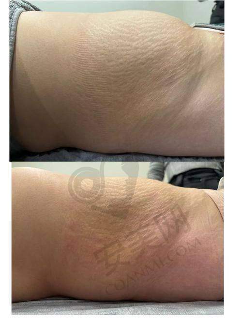 其他酷塑法定认证医院推荐