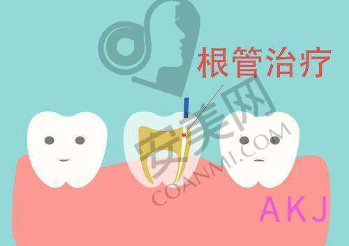 石家庄牙博士口腔医院牙齿根管治疗的特色有哪些?