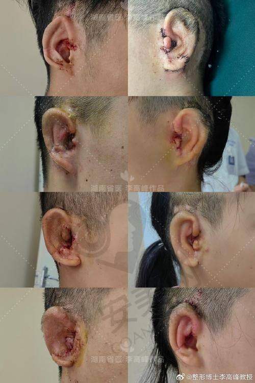 张正文医生的背景与资历