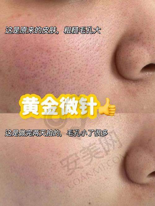 体验感提升:舒适与便捷的理想结合