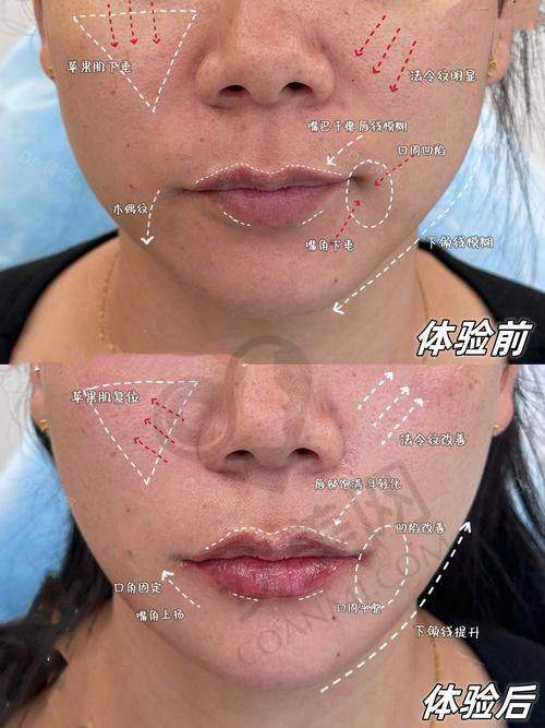 治疗后的护理需要注意什么?