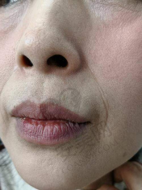 治疗后的成效如何?