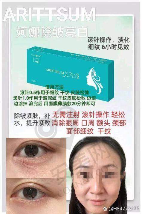 重庆星荣郑胜院长的口周年轻化方案有哪些优势?