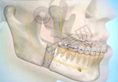 桂林华美医疗美容医院如何利用专精医生团队和精良技术设备打造高品质医美体验?