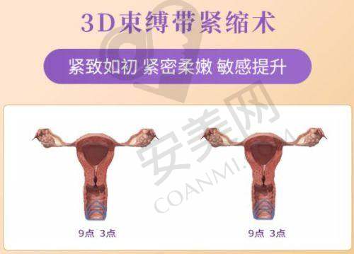 隆胸项目技术深度科普