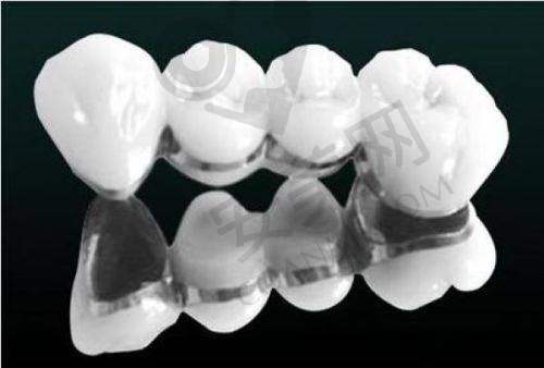 如何预约北京瑞泰口腔医院侯喜朋医生的韩国登腾种植牙项目?