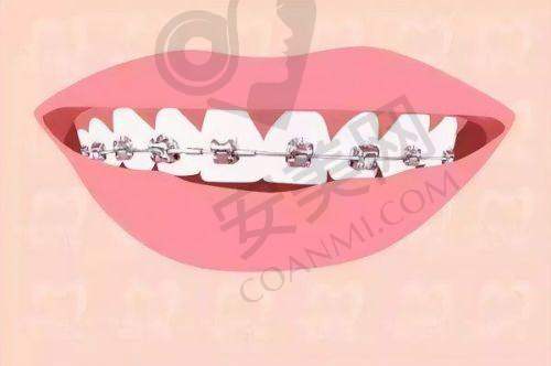 患者在北京极简海德堡口腔做瑞典诺贝尔种植牙的体验如何?