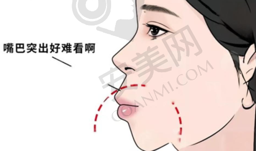 瑞典诺贝尔种植牙有什么特点?