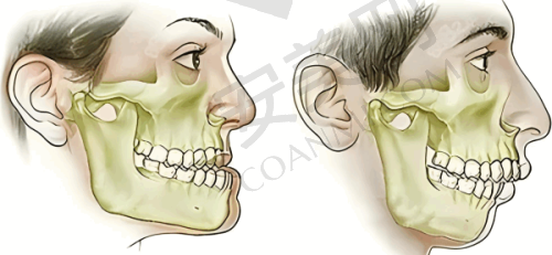 儿童早期干预矫正的好处有哪些?