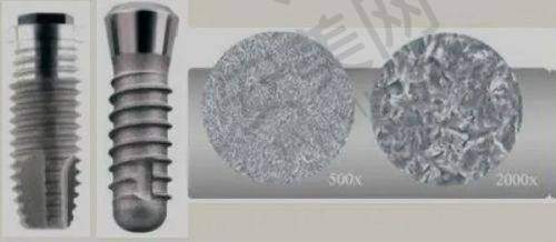 北京极简海德堡口腔瑞典诺贝尔种植牙的价格是如何分阶的?