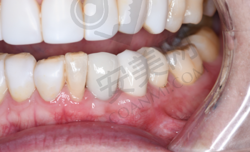 7980元起的价格意味着什么?