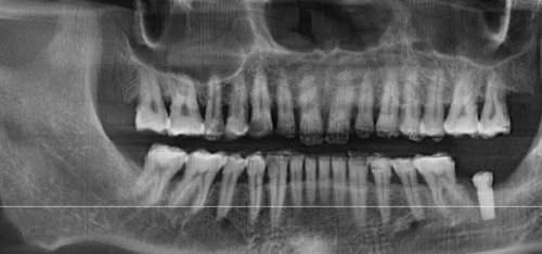 2、马鞍山鼎植口腔周路宽医生(擅长项目)怎么样?