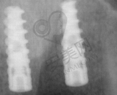 5、廊坊中科口腔王弄医生患者评价: