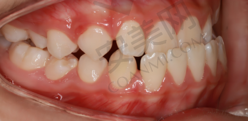 衢州蓝芽口腔是正规医院吗?