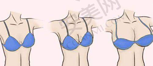 韦燕博医生:医美界的璀璨之星