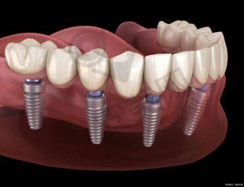 6、廊坊中科口腔王弄医生预约挂号指南