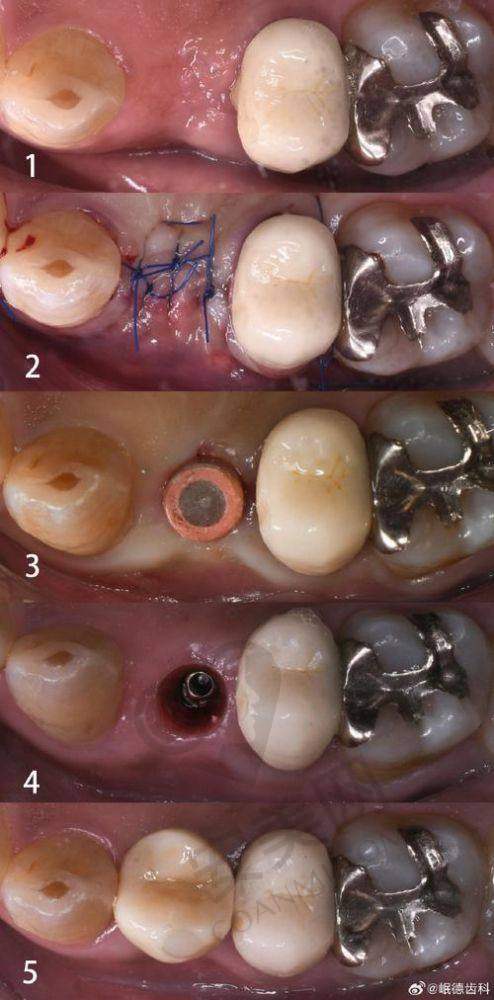 患者的真实反馈如何?