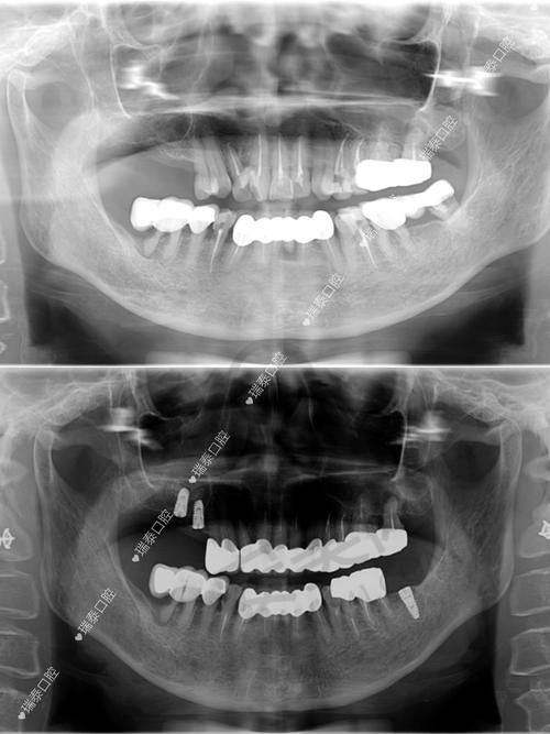 3、廊坊中科口腔王弄医生诊疗项目收费价格: