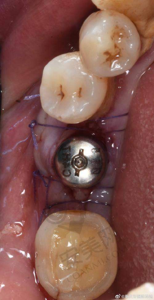 太原鼎植口腔医院是怎样的存在?