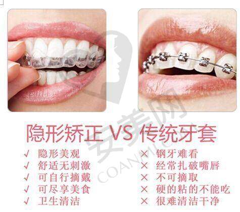 时代天使隐形矫正：美观与舒适并存