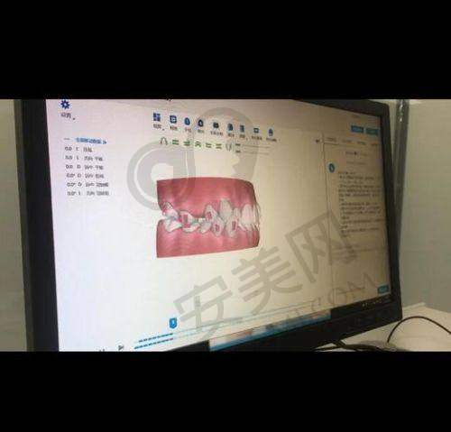 矫正流程：专精规范有保护