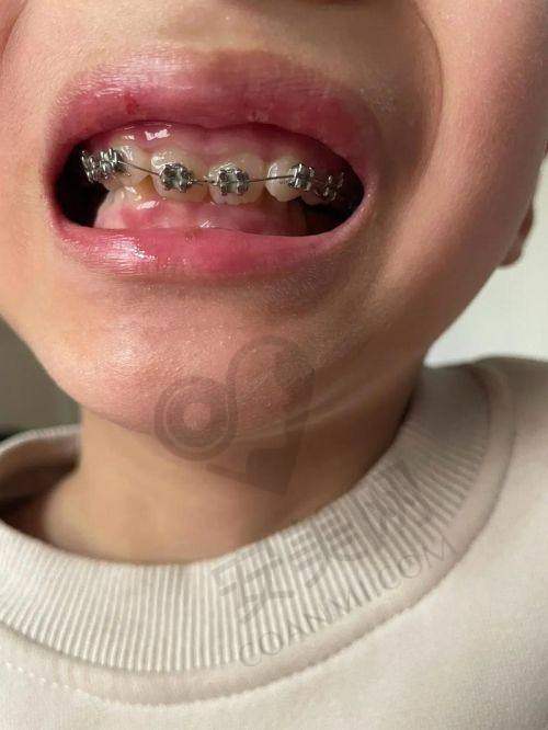 昆明拜博口腔医院的医疗团队如何?