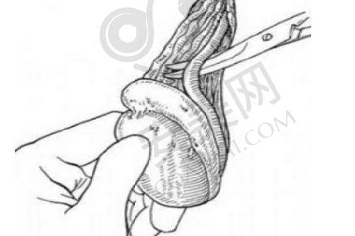 如何选择适合自己的紧肤提升方案