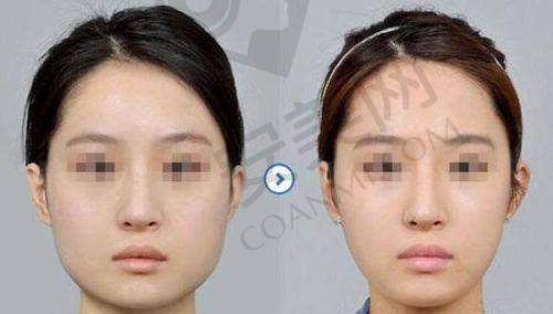 总结:选择聂云飞医生,开启美丽之旅