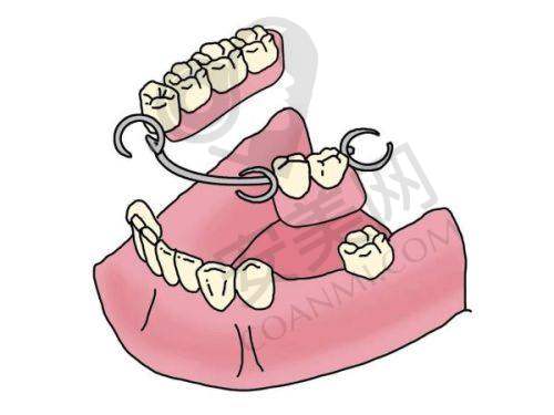 达州医大口腔医院全口吸附性义齿的制作流程是怎样的?