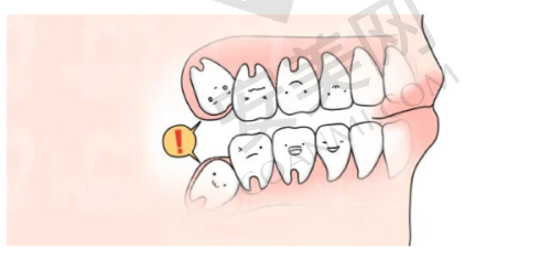 马鞍山鼎植口腔的瑞典诺贝尔cc种植牙有哪些成功实例？
