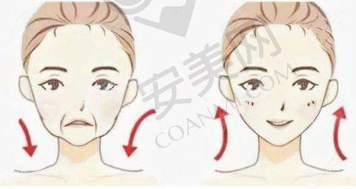 上海愉悦美联臣整形医院