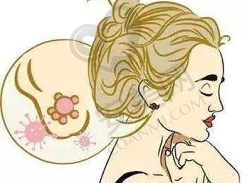 假体隆胸术后需要注意什么?