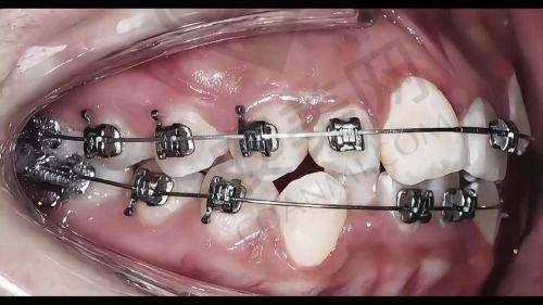 1、承德玥莱美口腔韩永刚医生怎么样?