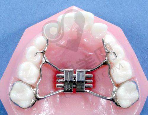 选择南京美奥口腔赵航医生做时代天使隐形矫正有哪些保护?