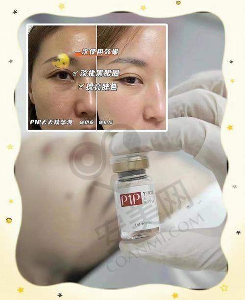 刘彦姣医生：专精技术为水光针成效保驾护航