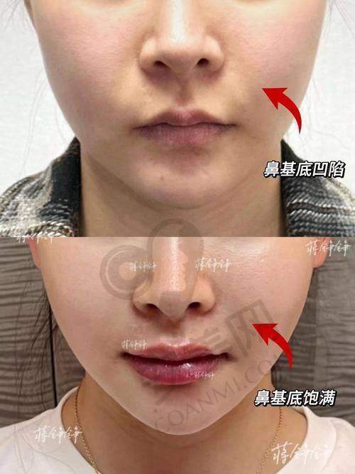 吴姗姗医生:专精成就美丽