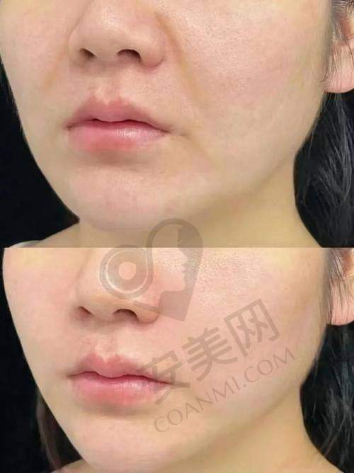 如何预约长沙美莱吴姗姗医生的治疗?