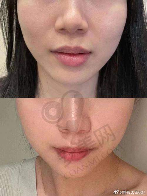 长沙美莱:专精医美机构的保护