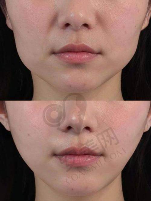 术前注意事项有哪些?